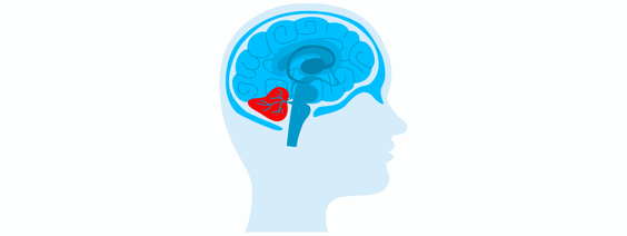 Cerebellar Ataxia and Physiotherapy